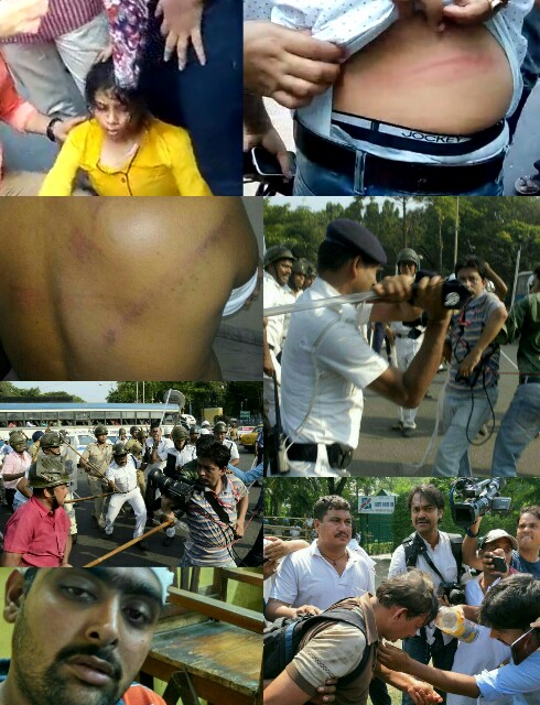 Press Freedom thrashed - Kolkata 2017 1