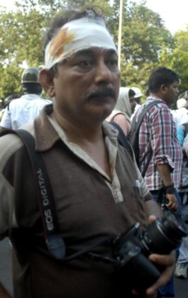 Press Freedom thrashed - Kolkata 2017 2